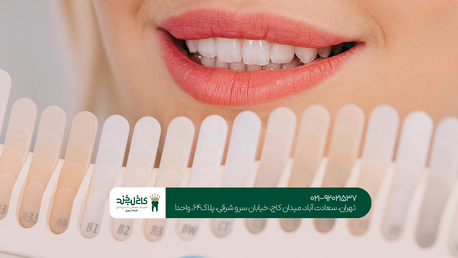 متخصص لمینت دندان