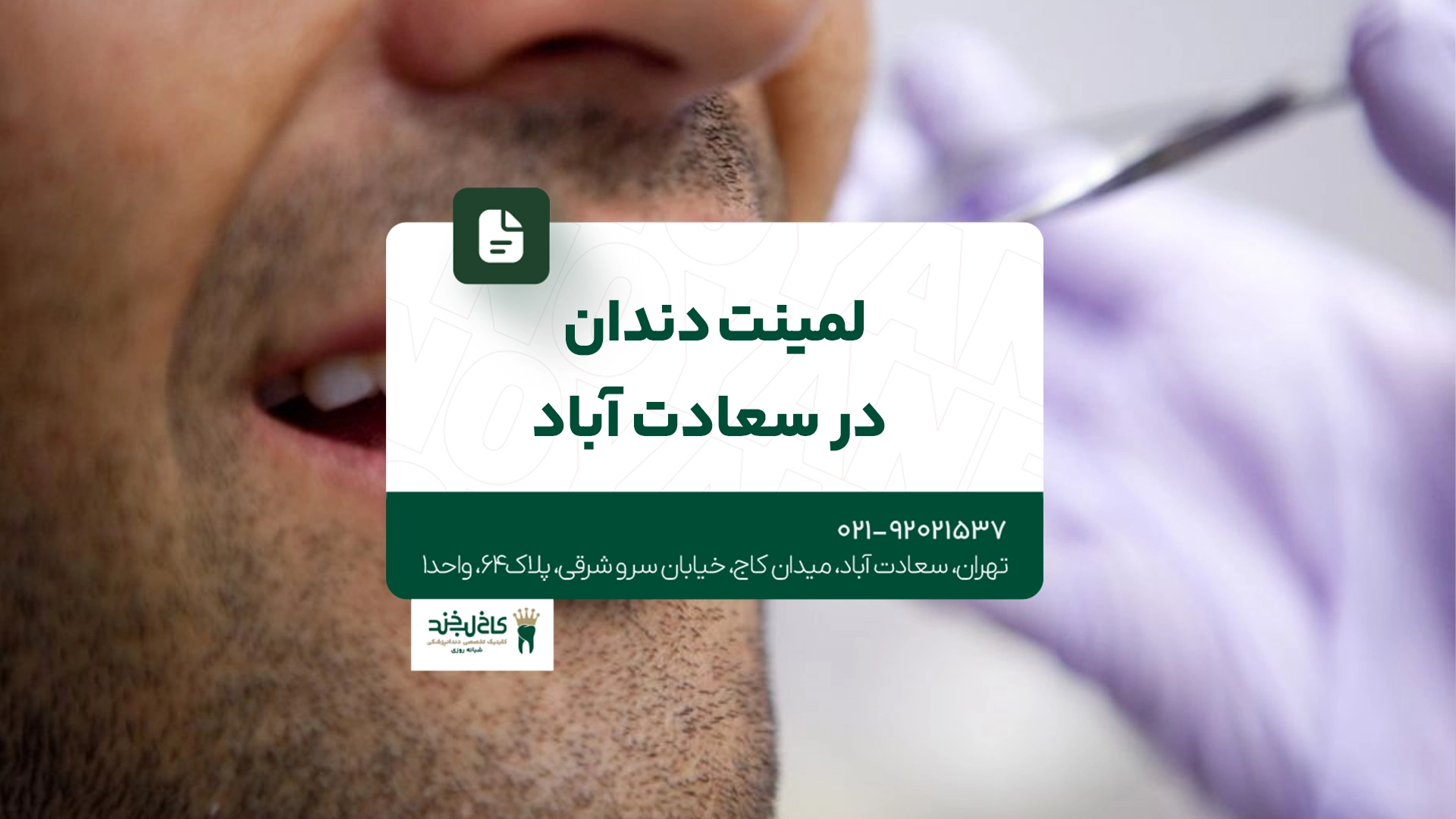 لمینت دندان در سعادت آباد لمینت دندان در سعادت آباد