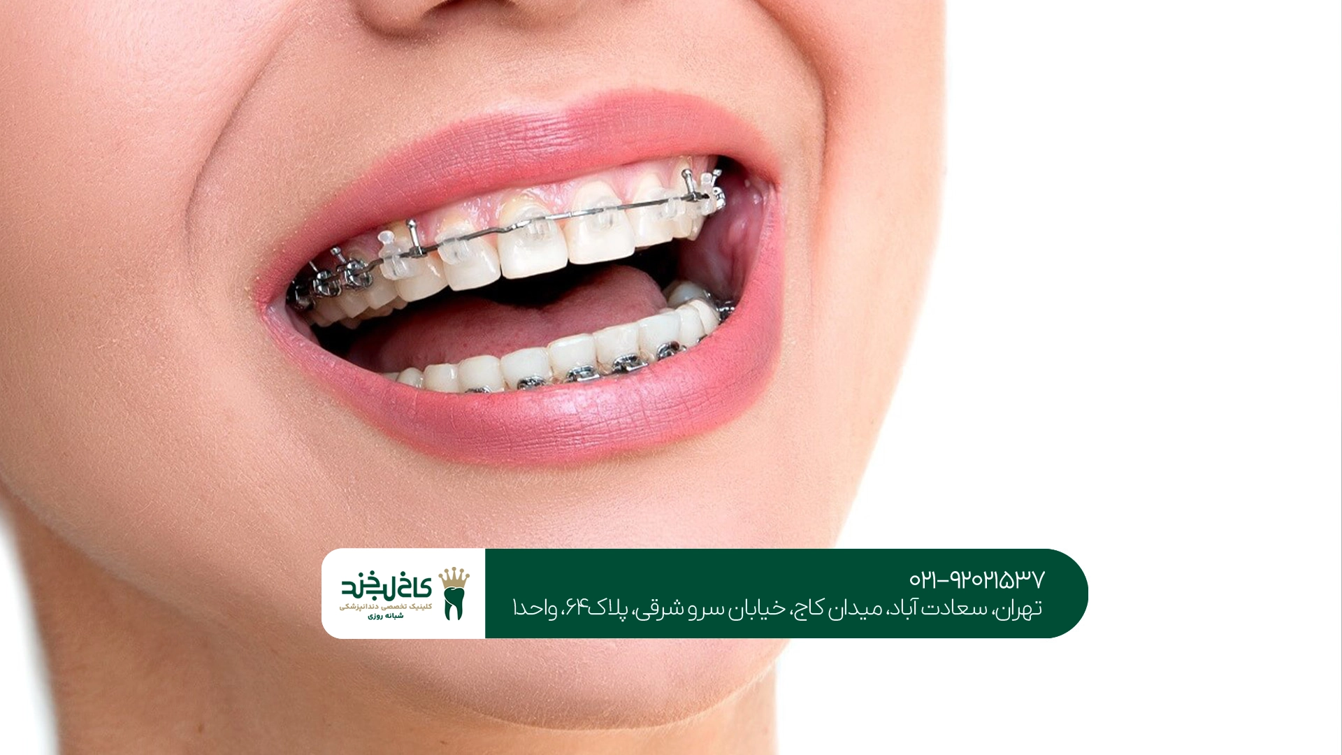 کلینیک ارتودنسی سعادت آباد کلینیک ارتودنسی سعادت آباد