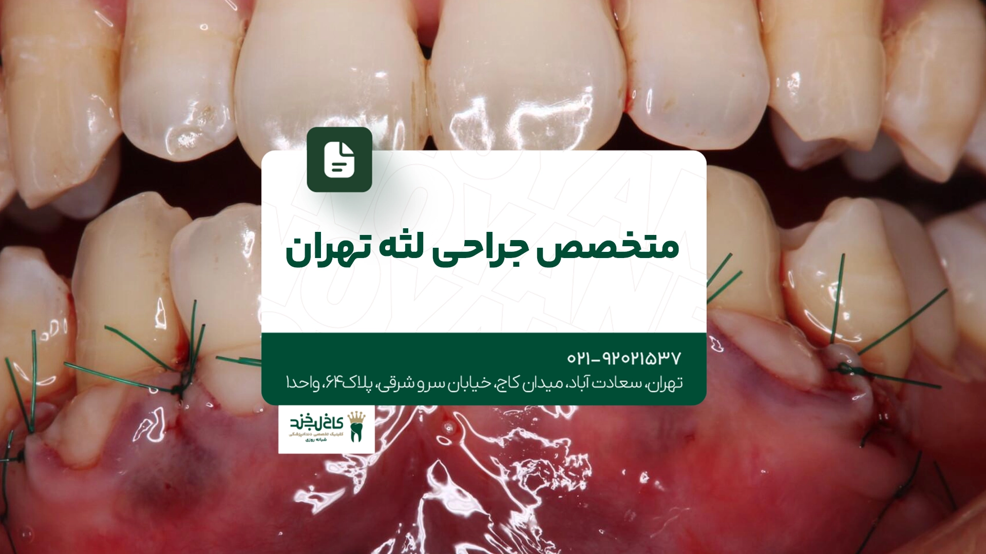 متخصص جراحی لثه تهران