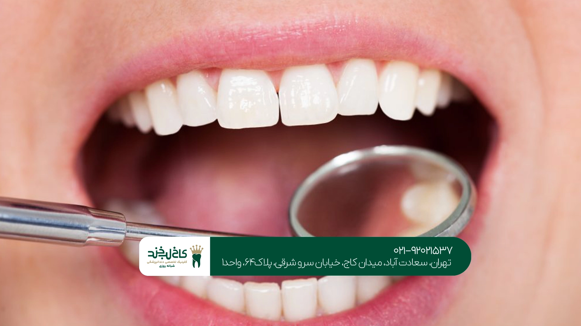 دندانپزشکی زیبایی حرفهای در سعادت آباد