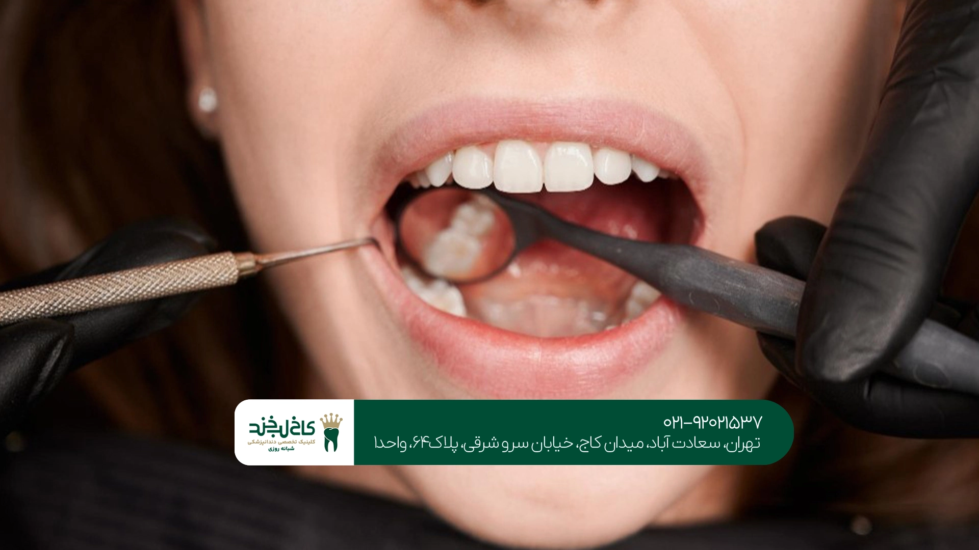 بهترین متخصص دندانپزشکی زیبایی سعادت آباد