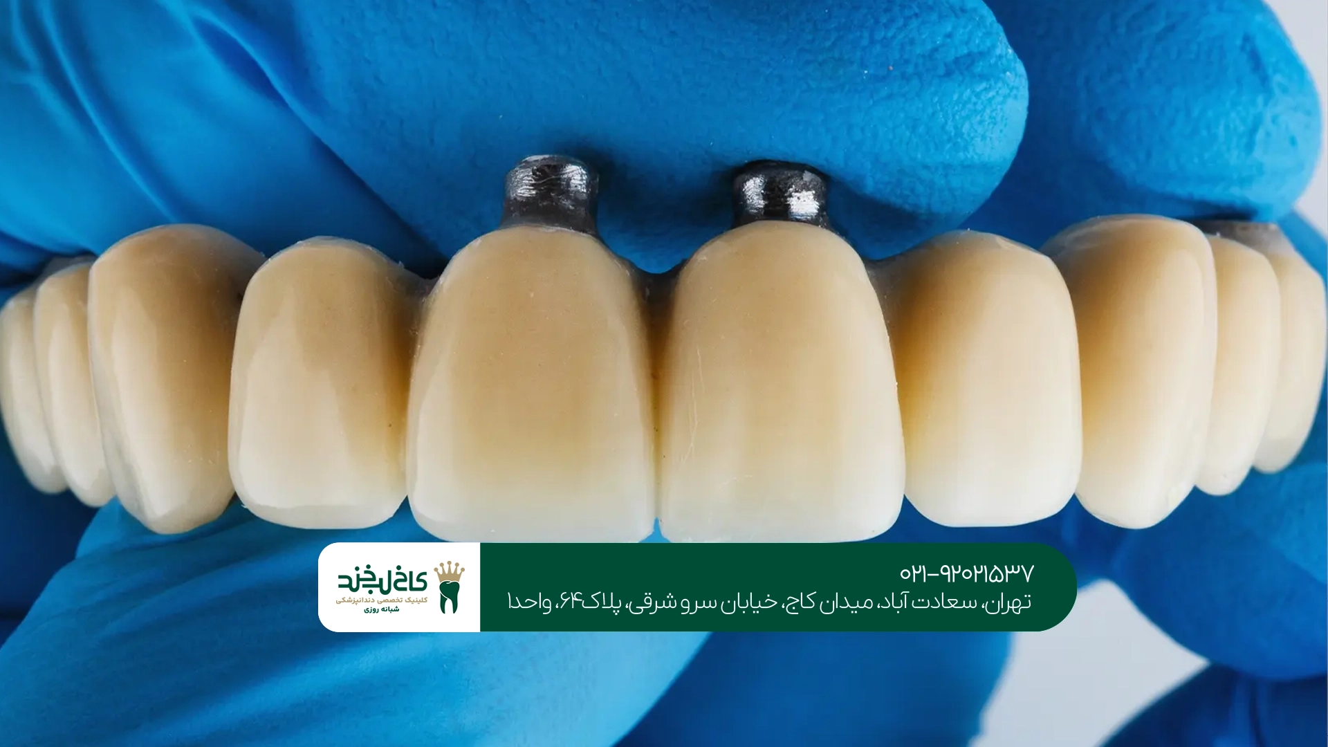 چگونه بهترین متخصص پروتز دندان را انتخاب کنیم؟