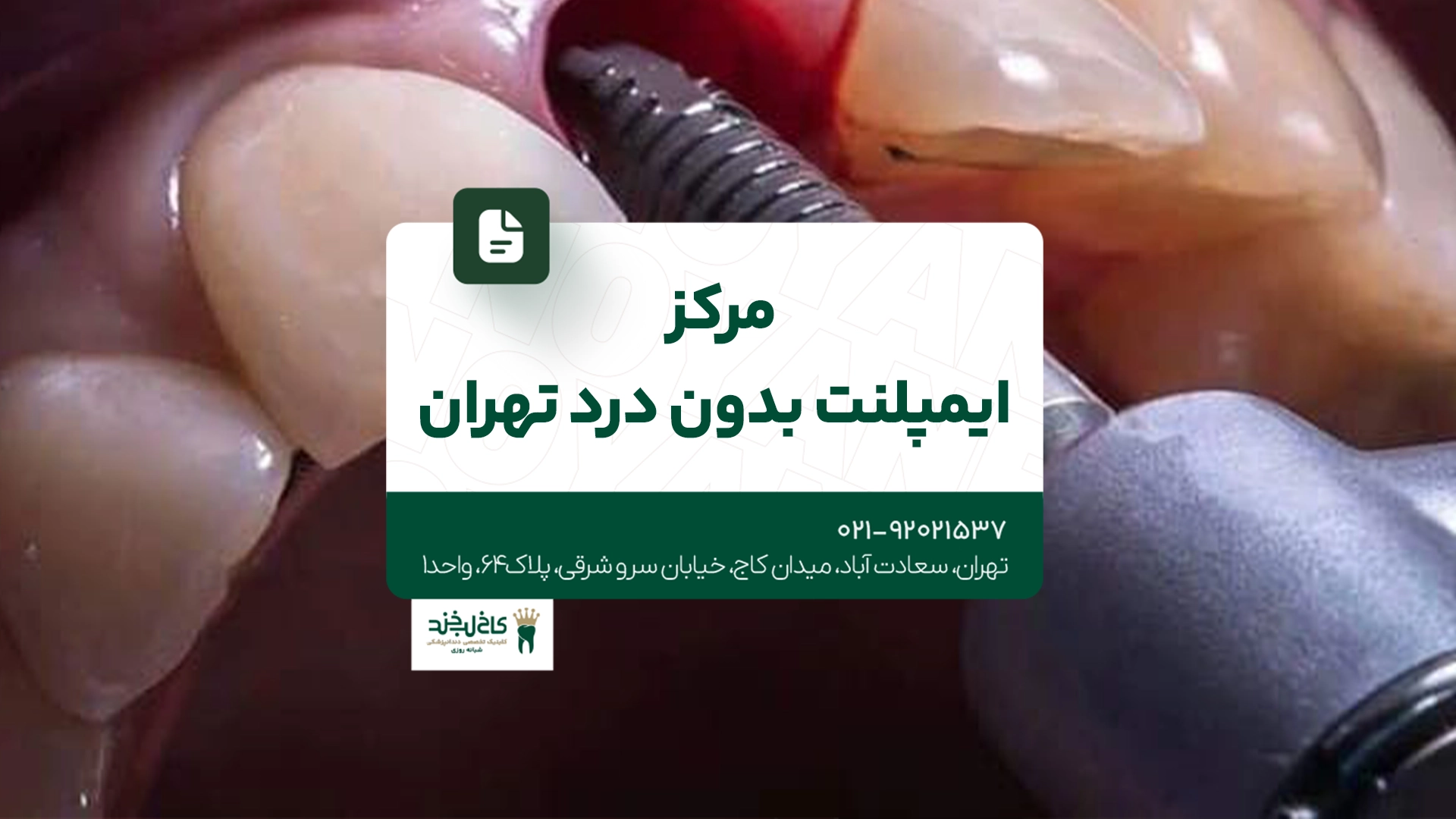 مرکز تخصصی عصب کشی دندان مرکز تخصصی عصب کشی دندان