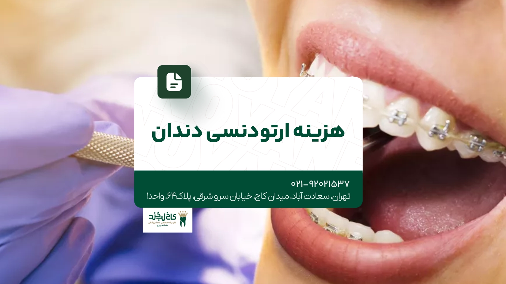 هزینه ارتودنسی دندان هزینه ارتودنسی دندان