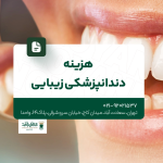 هزینه دندانپزشکی زیبایی