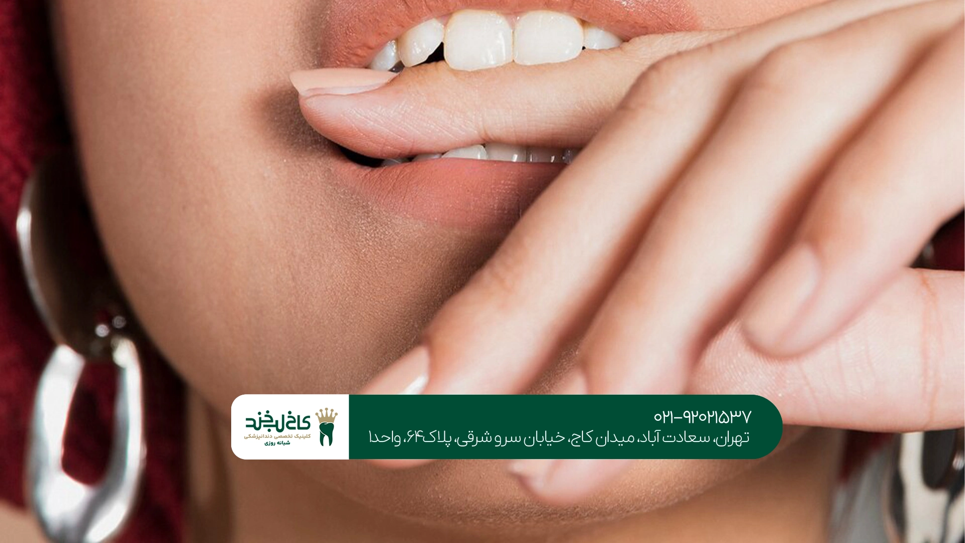 هزینه کامپوزیت، لمینت و بلیچینگ چه تفاوتی دارد؟ هزینه کامپوزیت، لمینت و بلیچینگ چه تفاوتی دارد؟