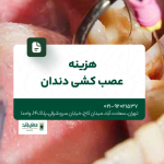 هزینه عصب کشی دندان