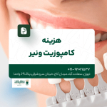 هزینه کامپوزیت ونیر