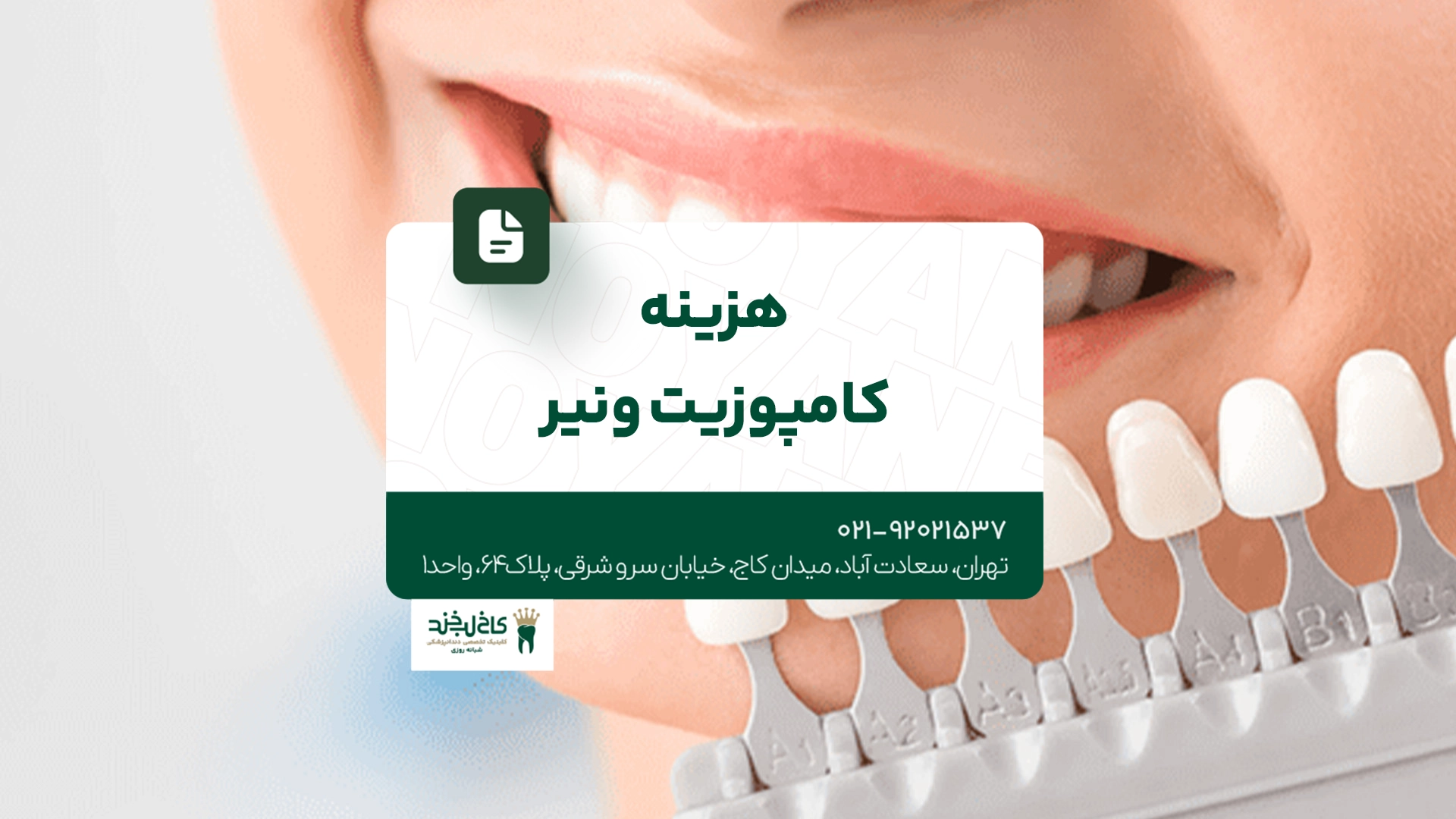 هزینه کامپوزیت ونیر