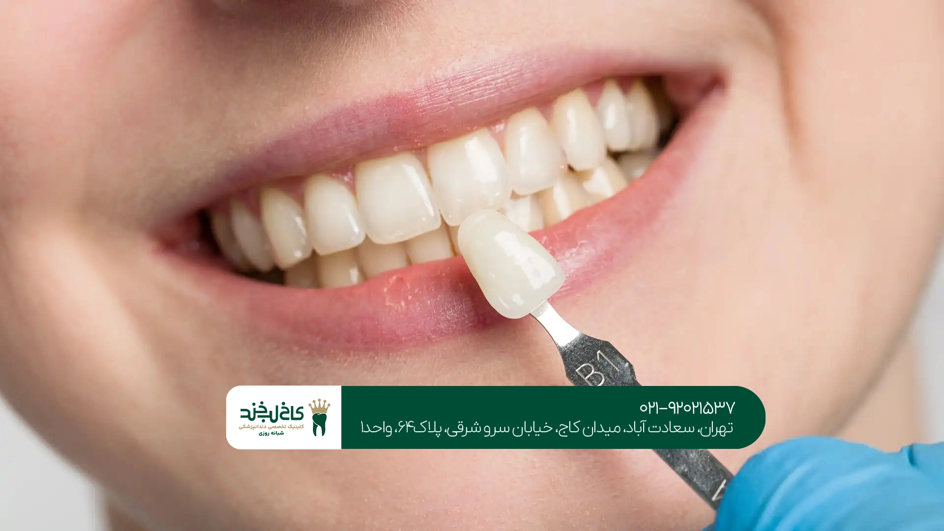 متخصص کامپوزیت ونیر در تهران