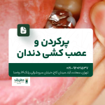 پر کردن و عصب کشی دندان