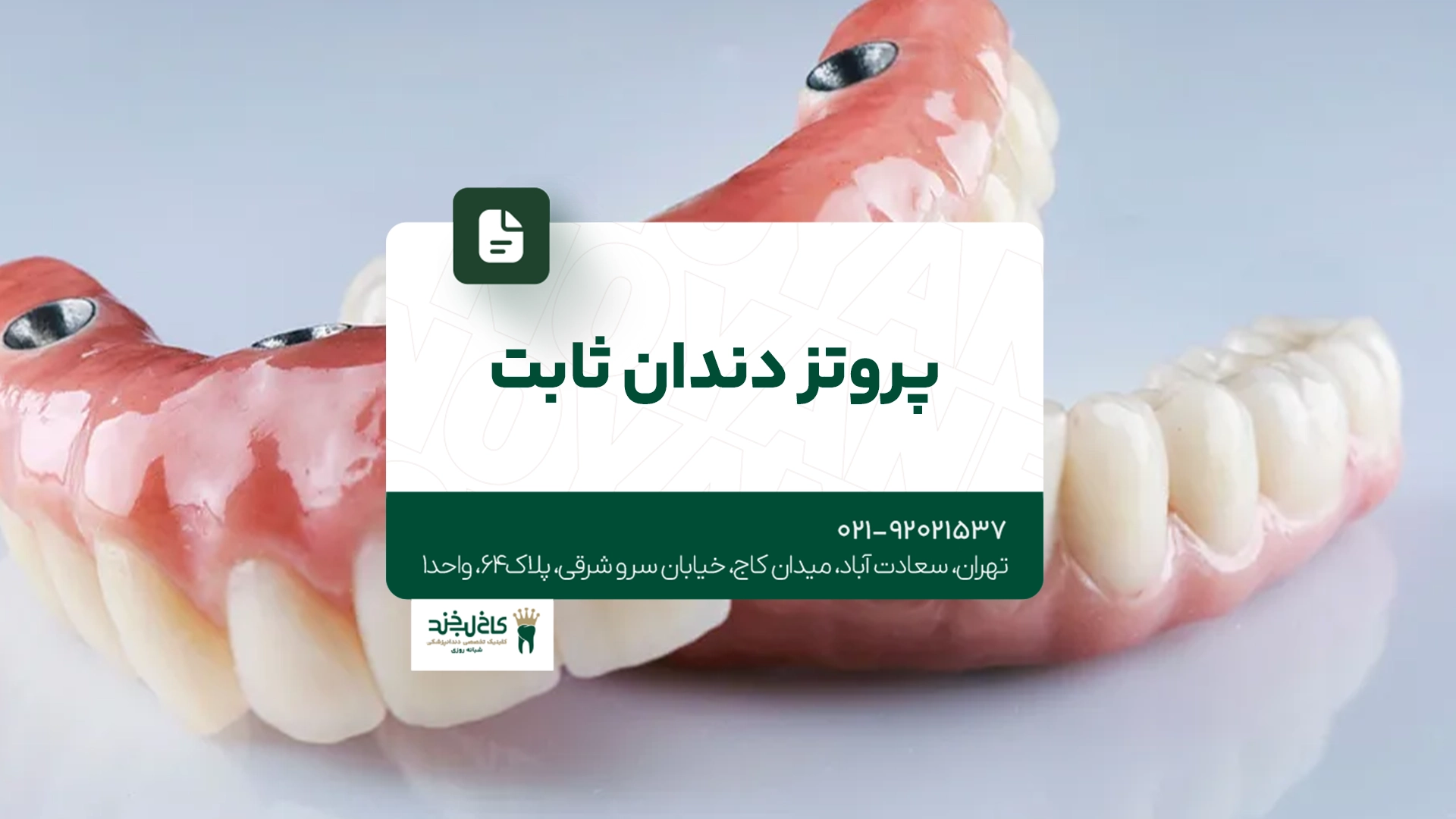 پروتز دندان ثابت پروتز دندان ثابت