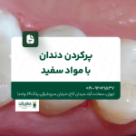 پر کردن دندان با مواد سفید
