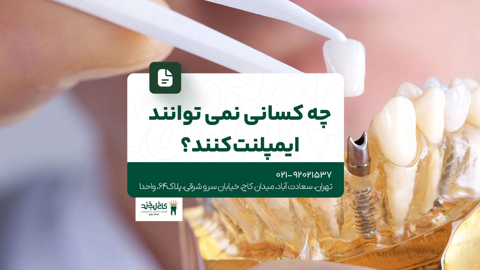 چه کسانی نمیتوانند ایمپلنت کنند؟