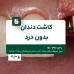 کاشت دندان بدون درد