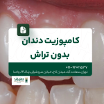کامپوزیت دندان بدون تراش