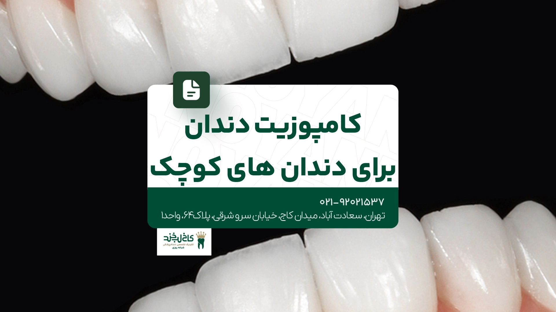کامپوزیت دندان برای دندانهای کوچک