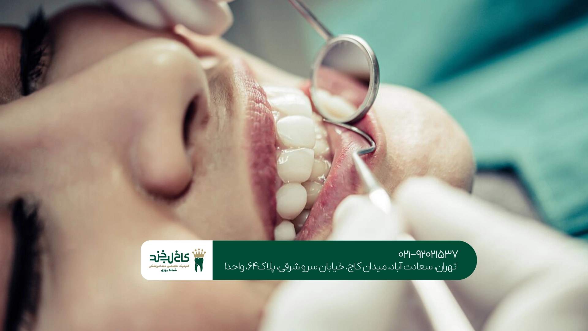 کلینیک کامپوزیت دندانهای کوچک