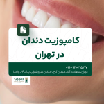 کامپوزیت دندان در تهران