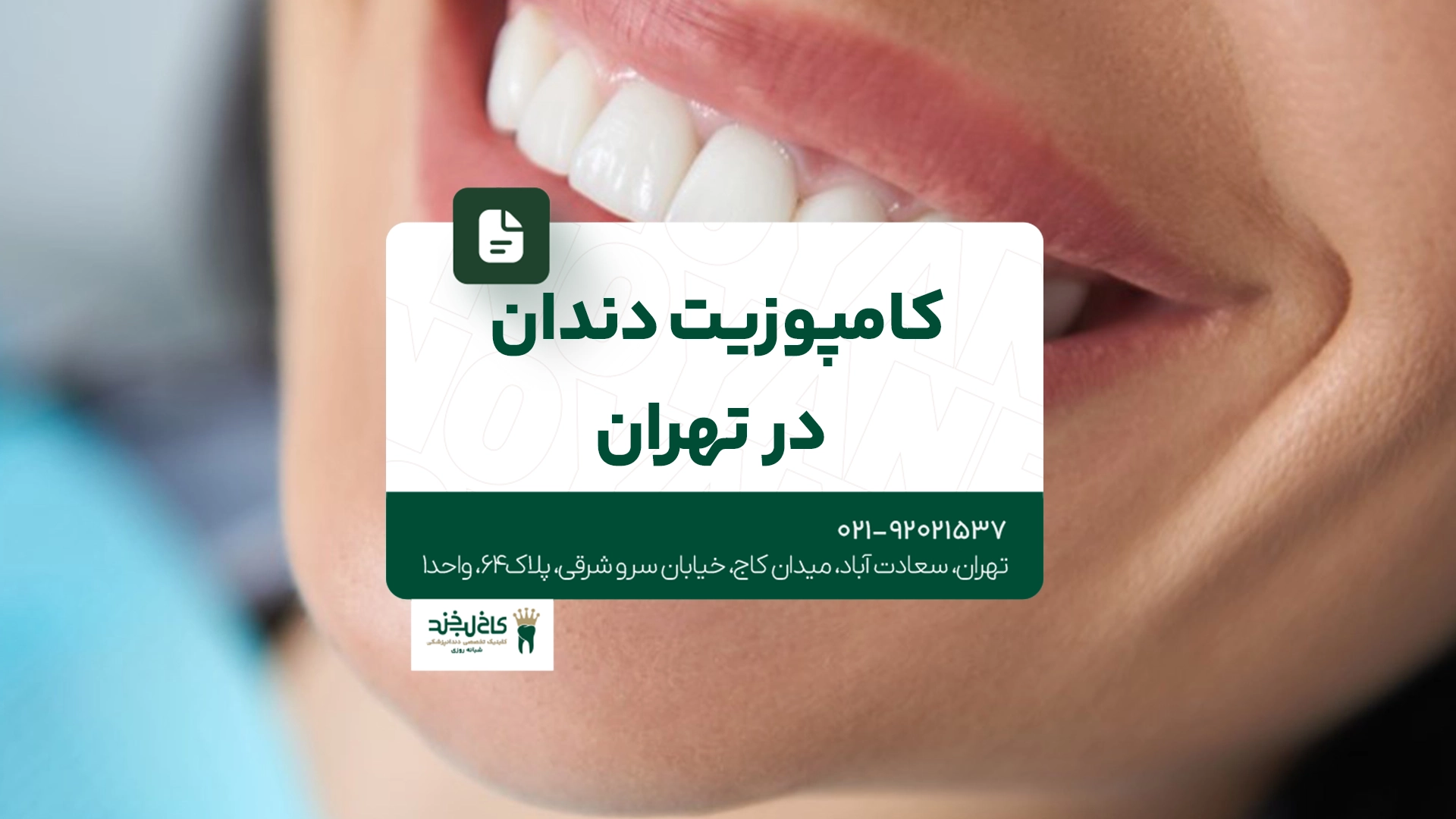 کامپوزیت دندان در تهران