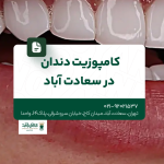 کامپوزیت دندان در سعادت آباد