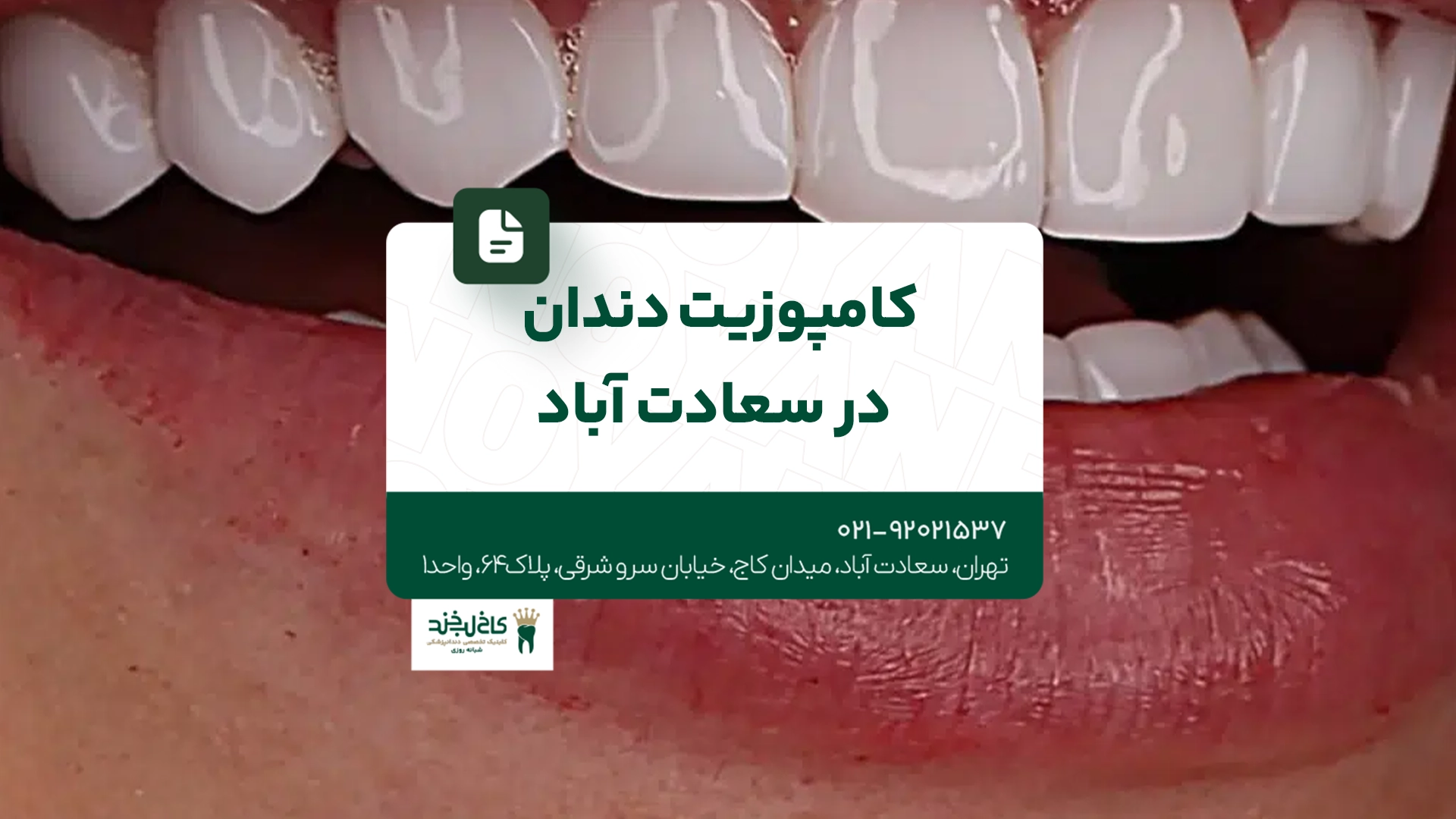 کامپوزیت دندان در سعادت آباد