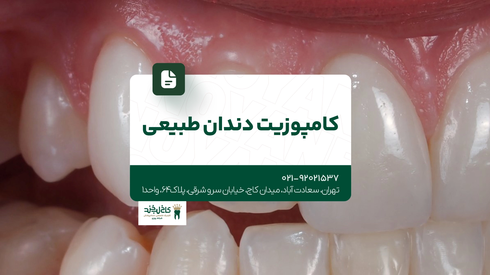 کامپوزیت دندان طبیعی