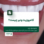 کامپوزیت ونیر چیست