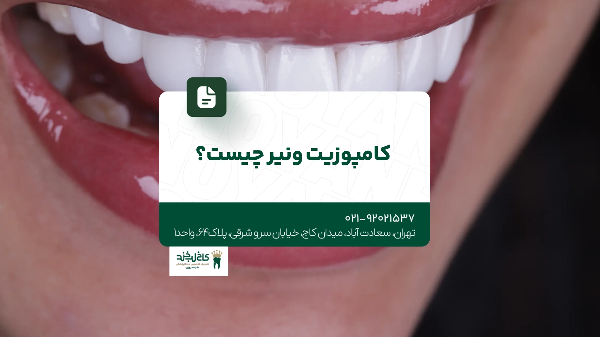 کامپوزیت ونیر چیست