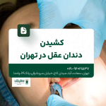 کشیدن دندان عقل در تهران