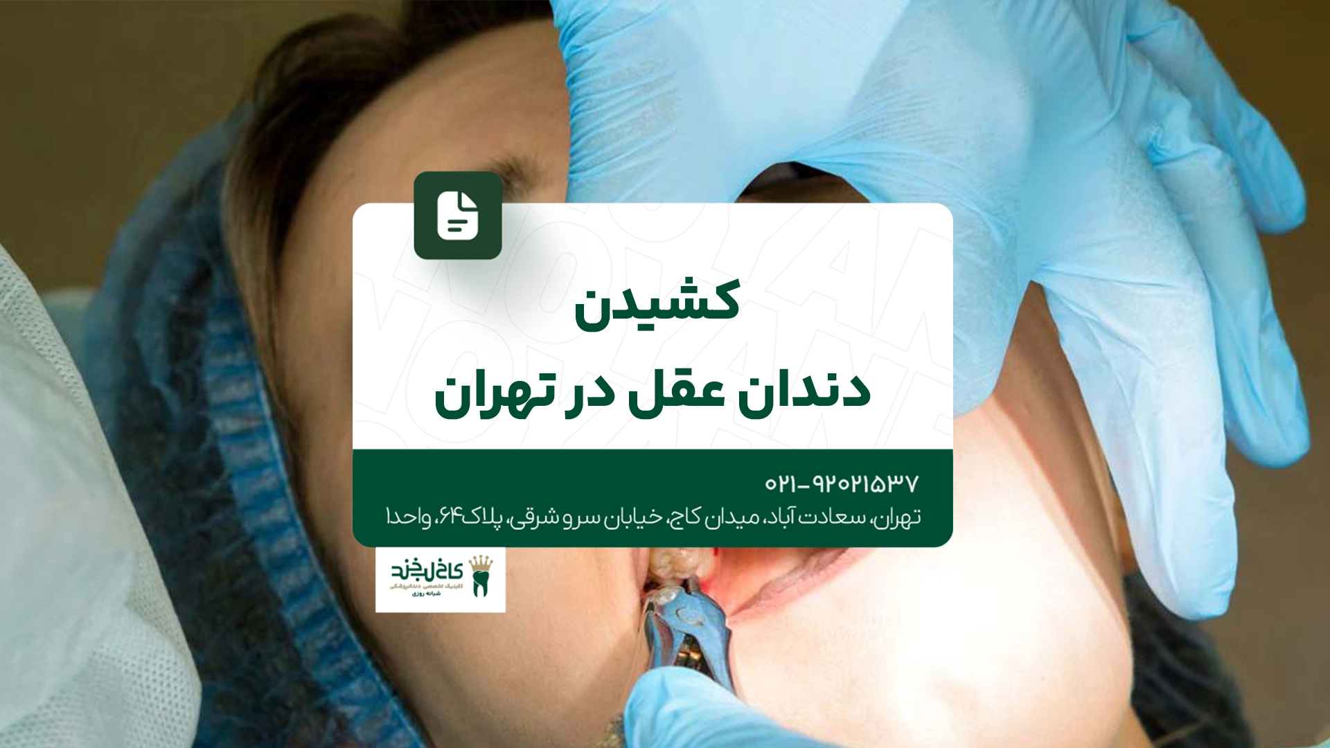 کشیدن دندان عقل در تهران