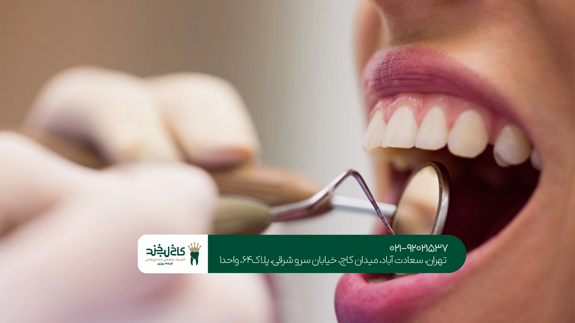 هزینه خدمات کلینیک دندانپزشکی سعادت آباد تهران