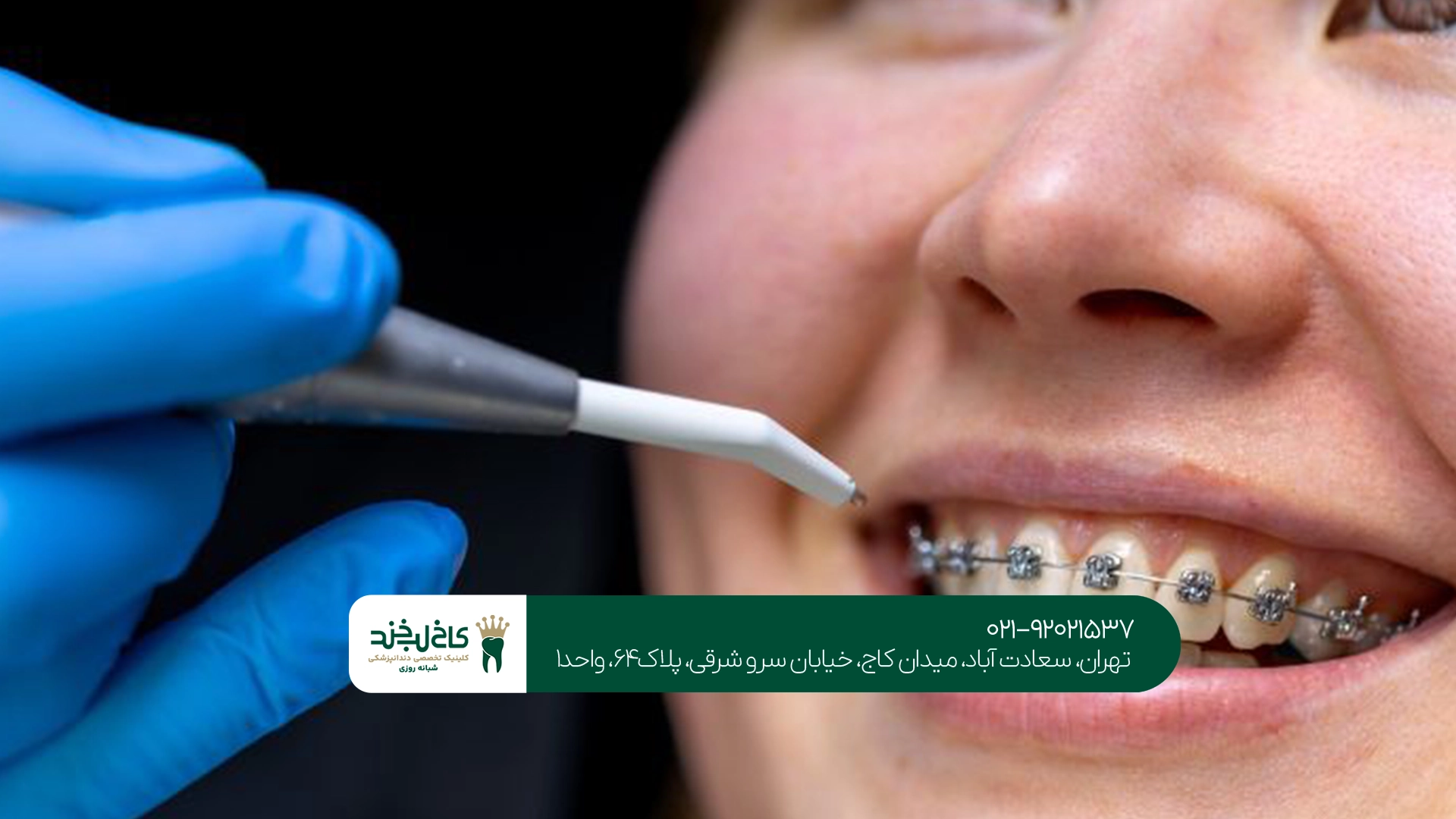 متخصص ارتودنسی ثابت تهران