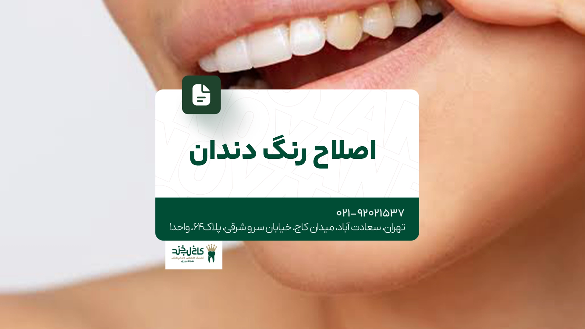 اصلاح رنگ دندان اصلاح رنگ دندان