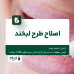 اصلاح طرح لبخند