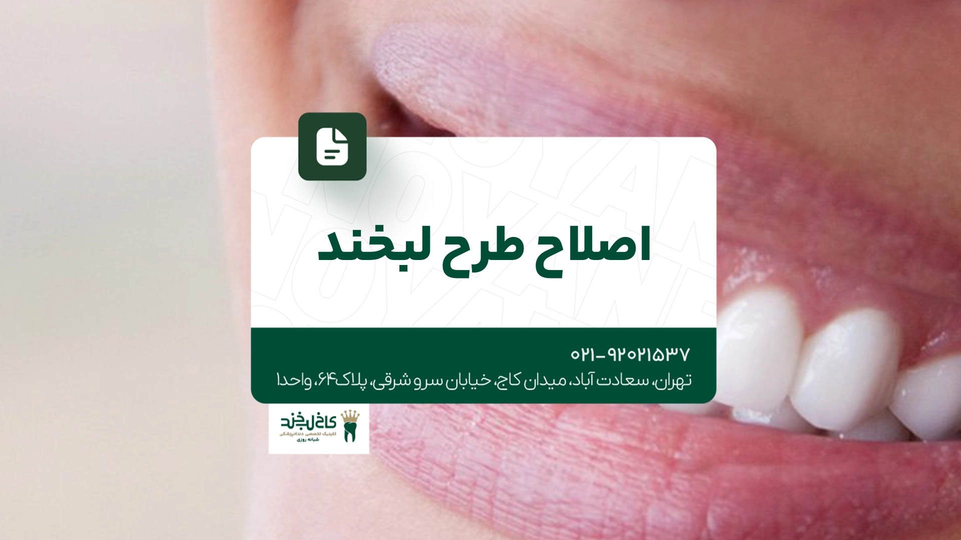 اصلاح طرح لبخند اصلاح طرح لبخند