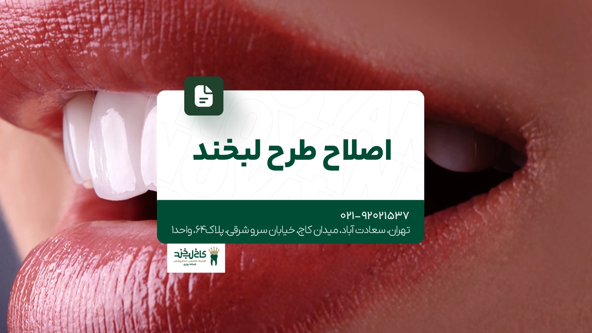 اصلاح طرح لبخند اصلاح طرح لبخند
