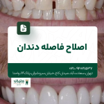 اصلاح فاصله دندان