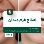 اصلاح فرم دندان
