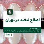 اصلاح لبخند در تهران