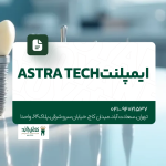 ایمپلنت Astra Tech