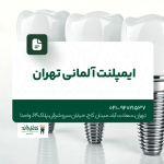 ایمپلنت آلمانی تهران