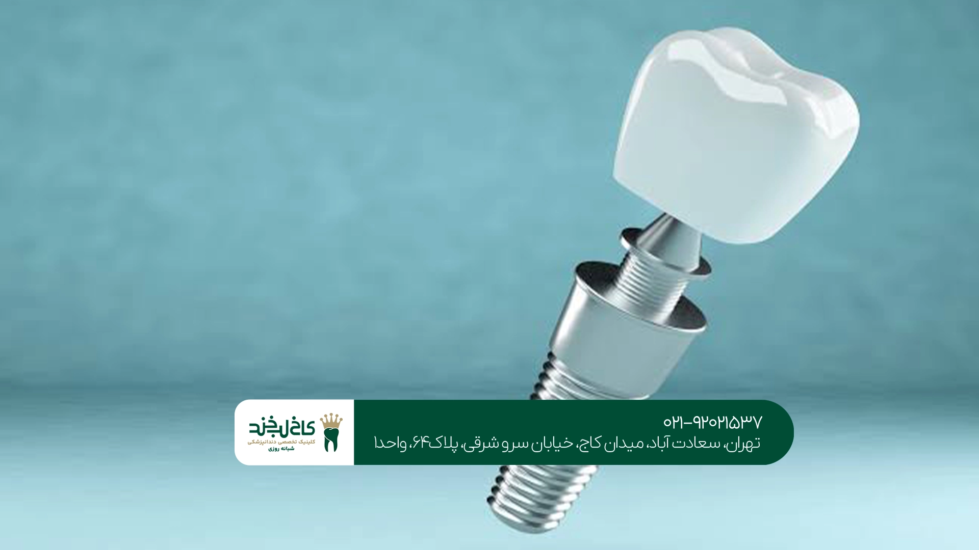 بهترین ایمپلنت آلمانی در تهران