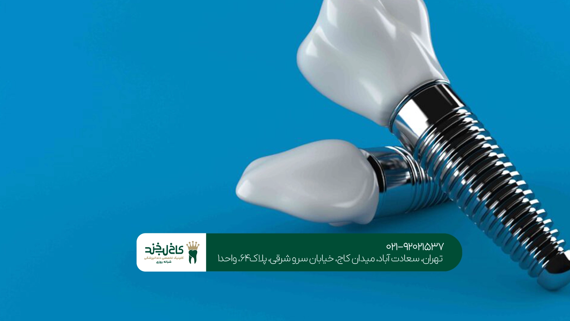 قیمت ایمپلنت آلمانی به چه عواملی بستگی دارد؟