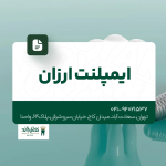 ایمپلنت ارزان تهران