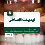ایمپلنت اقساطی تهران