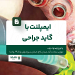 ایمپلنت با گاید جراحی
