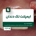ایمپلنت تک دندان