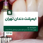ایمپلنت دندان تهران